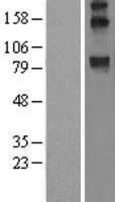 Western Blot: WFS1 Overexpression Lysate [NBL1-17845]