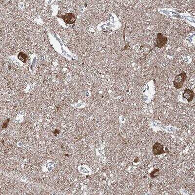 Immunohistochemistry-Paraffin: WHAMM Antibody [NBP1-89593]