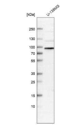 Western Blot: WHAMM Antibody [NBP1-89592]