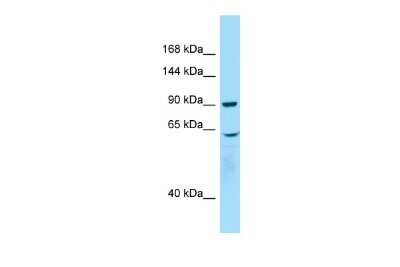 Western Blot: WHAMM Antibody [NBP2-86381]