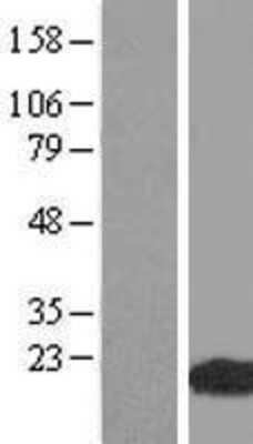 Western Blot: WHAMML1 Overexpression Lysate [NBL1-17846]