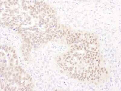 Immunohistochemistry-Paraffin: WHIP Antibody [NB110-61626]
