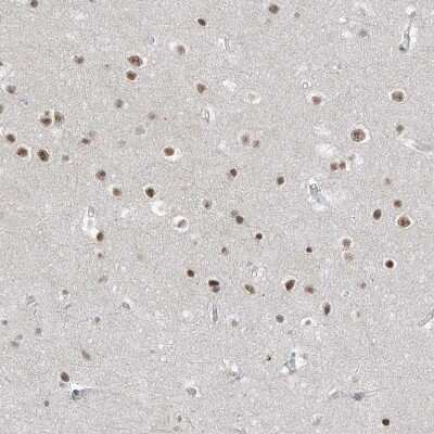 Immunohistochemistry-Paraffin: WHIP Antibody [NBP2-38190]
