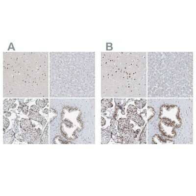 Immunohistochemistry-Paraffin: WHIP Antibody [NBP2-38190]