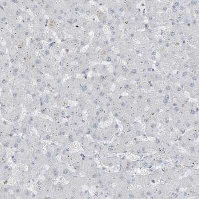 Immunohistochemistry-Paraffin: WHIP Antibody [NBP2-38190]