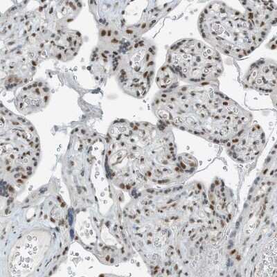 Immunohistochemistry-Paraffin: WHIP Antibody [NBP2-38190]