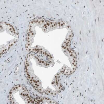 Immunohistochemistry-Paraffin: WHIP Antibody [NBP2-38190]