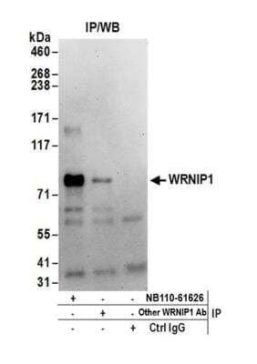Immunoprecipitation: WHIP Antibody [NB110-61626]