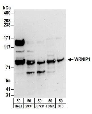 Western Blot: WHIP Antibody [NB110-61626]