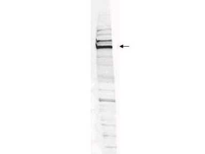 Western Blot: WHIP Antibody [NBP1-77987]