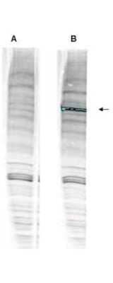 Western Blot: WHIP Antibody [NBP1-77987]