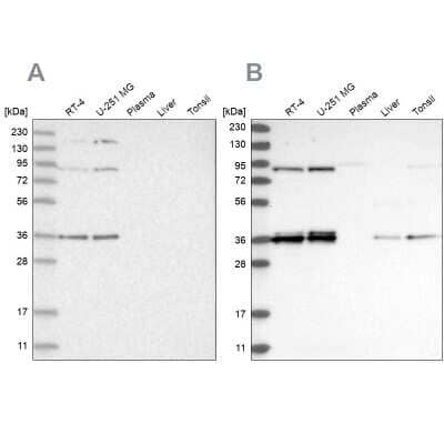 Western Blot: WHIP Antibody [NBP1-90030]