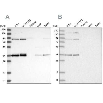 Western Blot: WHIP Antibody [NBP2-38190]