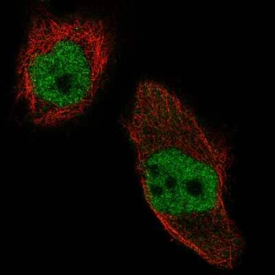 Immunocytochemistry/ Immunofluorescence: WHSC1 Antibody (CL1057) [NBP2-52962]