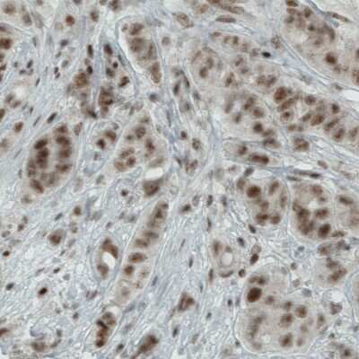 Immunohistochemistry-Paraffin: WHSC1 Antibody (CL1057) [NBP2-52962]