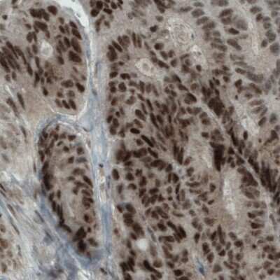 Immunohistochemistry-Paraffin: WHSC1 Antibody (CL1057) [NBP2-52962]