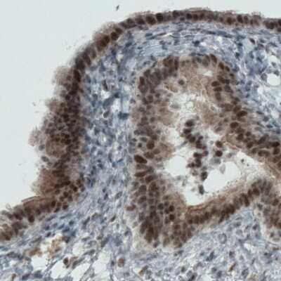 Immunohistochemistry-Paraffin: WHSC1 Antibody (CL1057) [NBP2-52962]