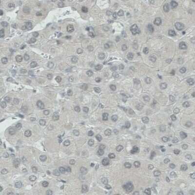 Immunohistochemistry-Paraffin: WHSC1 Antibody (CL1057) [NBP2-52962]