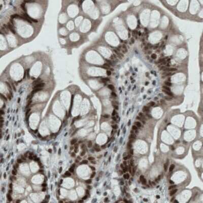 Immunohistochemistry-Paraffin: WHSC1 Antibody (CL1057) [NBP2-52962]