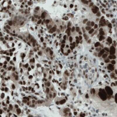 Immunohistochemistry-Paraffin: WHSC1 Antibody (CL1057) [NBP2-52962]