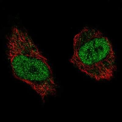 Immunocytochemistry/ Immunofluorescence: WHSC1 Antibody (CL1063) [NBP2-52963]
