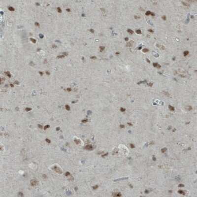 Immunohistochemistry-Paraffin: WHSC1 Antibody (CL1063) [NBP2-52963]