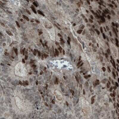 Immunohistochemistry-Paraffin: WHSC1 Antibody (CL1063) [NBP2-52963]