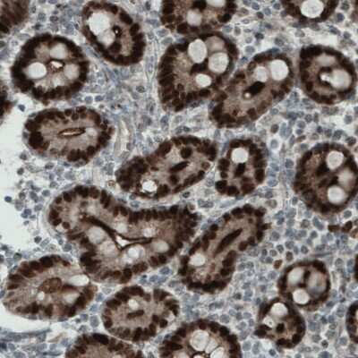 Immunohistochemistry-Paraffin: WHSC1 Antibody (CL1063) [NBP2-52963]