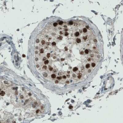 Immunohistochemistry-Paraffin: WHSC1 Antibody (CL1063) [NBP2-52963]