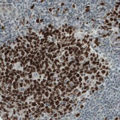 Immunohistochemistry-Paraffin: WHSC1 Antibody (CL1063) [NBP2-52963]