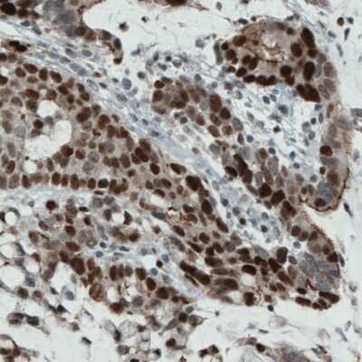 Immunohistochemistry-Paraffin: WHSC1 Antibody (CL1063) [NBP2-52963]