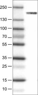 Western Blot: WHSC1 Antibody (CL1063) [NBP2-52963]