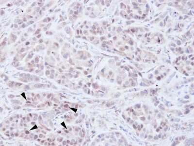 Immunohistochemistry-Paraffin: WHSC1 Antibody [NBP1-30910]