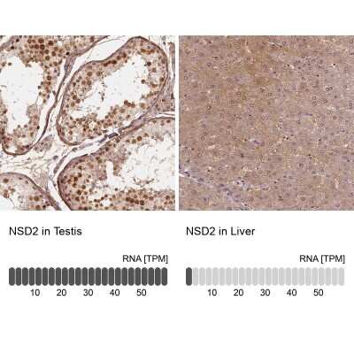 Immunohistochemistry-Paraffin: WHSC1 Antibody [NBP1-82633]