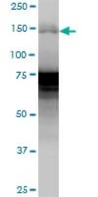 Western Blot: WHSC1 Antibody [H00007468-B01P]