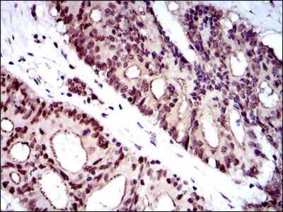 Immunohistochemistry: WHSC2 Antibody (6B11H8) - BSA Free [NBP2-37394]