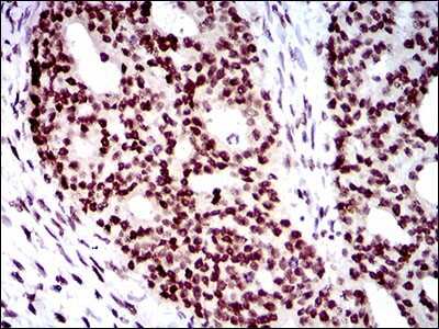 Immunohistochemistry: WHSC2 Antibody (6B11H8) - BSA Free [NBP2-37394]