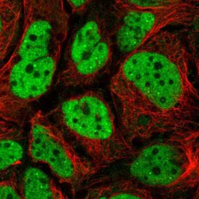 Immunocytochemistry/ Immunofluorescence: WHSC2 Antibody [NBP2-38454]