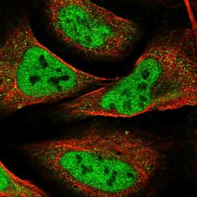 Immunocytochemistry/ Immunofluorescence: WHSC2 Antibody [NBP2-55447]