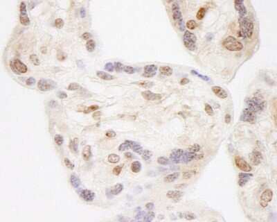 Immunohistochemistry-Paraffin: WHSC2 Antibody [NBP1-05975]