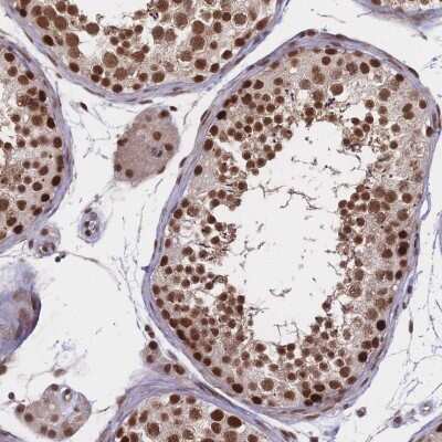 Immunohistochemistry-Paraffin: WHSC2 Antibody [NBP2-38454]