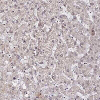 Immunohistochemistry-Paraffin: WHSC2 Antibody [NBP2-38454]