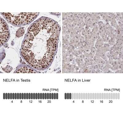 Immunohistochemistry-Paraffin: WHSC2 Antibody [NBP2-38454]