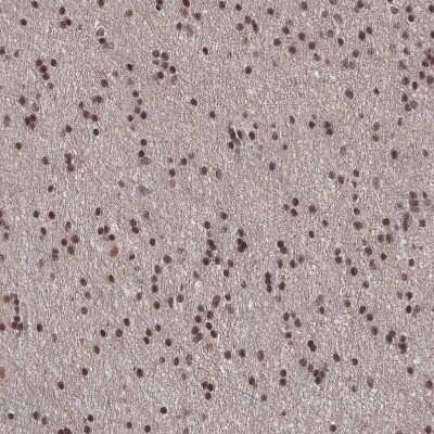 Immunohistochemistry-Paraffin: WHSC2 Antibody [NBP2-38454]