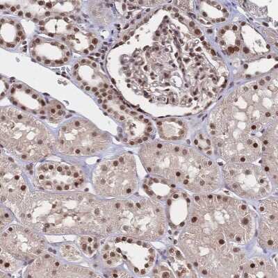 Immunohistochemistry-Paraffin: WHSC2 Antibody [NBP2-38454]