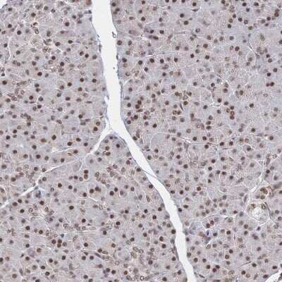 Immunohistochemistry-Paraffin: WHSC2 Antibody [NBP2-38454]