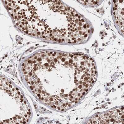 Immunohistochemistry-Paraffin: WHSC2 Antibody [NBP2-38454]