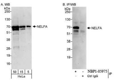 Western Blot: WHSC2 Antibody [NBP1-05975]