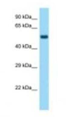 Western Blot: WHSC2 Antibody [NBP1-98456]