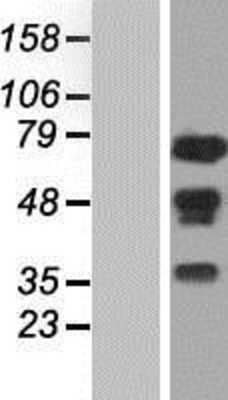 Western Blot: WHSC2 Overexpression Lysate [NBP2-07719]